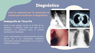 Inicial es casi siempre normal en el 90% de los
enfermos, si embargo revela aire libre en el
mediastino y/o peritoneo como la primera
manifestación radiológica
Radiografía de Tórax PA
Diagnóstico
Horas a días después, se podría encontrar derrame
pleural con o sin neumotórax, mediastino
ensanchado, enfisema subcutáneo (1 h), e incluso un
empiema o abscesos
Ante la sospecha por la anamnesis se
solicita para confirmar el diagnóstico:
 