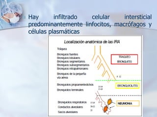    Hay       infiltrado celular     intersticial
    predominantemente linfocitos, macrófagos y
    células plasmáticas
 