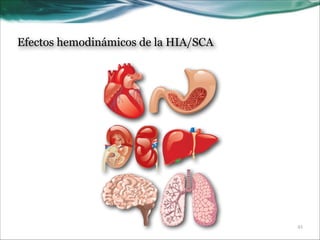 Efectos hemodinámicos de la HIA/SCA

!21

 