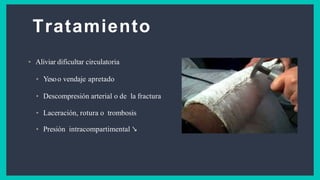 Tratamiento
• Aliviar dificultar circulatoria
• Yesoo vendaje apretado
• Descompresión arterial o de la fractura
• Laceración, rotura o trombosis
• Presión intracompartimental ↘
 