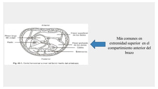 Más comunes en
extremidad superior en el
compartimiento anterior del
brazo
 