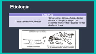 Etiología
EXTERNAS
Yesos Demasiado Apretados
Compresiones por superficies o bordes
durante un tiempo prolongado en
pacientes desmayados o bajo los efectos
de alguna droga
 