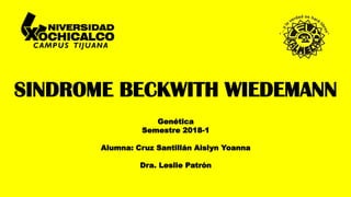 Sindrome de beckwith wiedemann | PDF