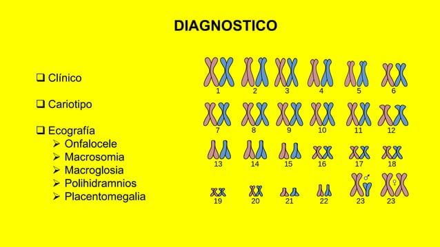 Sindrome de beckwith wiedemann | PDF | Genetics | Science
