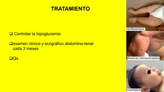 Sindrome de beckwith wiedemann | PDF