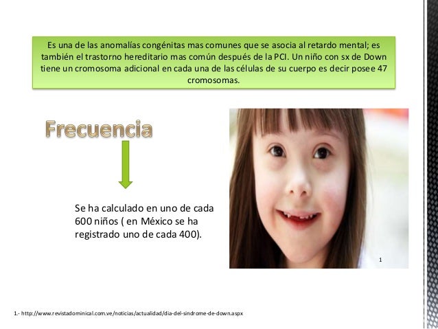 Manejo del paciente con Sindrome de Down en el condultorio dental.