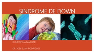 SINDROME DE DOWN
R1 MEDICINA FAMILIAR
DR. JOSE JUAN RODRIGUEZ
 