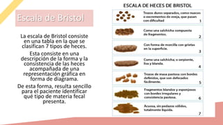 La escala de Bristol consiste
en una tabla en la que se
clasifican 7 tipos de heces.
Esta consiste en una
descripción de la forma y la
consistencia de las heces
acompañada de una
representación gráfica en
forma de diagrama.
De esta forma, resulta sencillo
para el paciente identificar
qué tipo de materia fecal
presenta.
Escala de Bristol
 