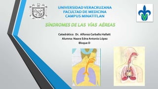 Catedrático: Dr. Alfonso Carballo Hallatt
Alumna: Naara Edna Antonio López
Bloque D

 