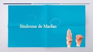 2
Síndrome de Marfan
 