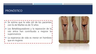 PRONÓSTICO
 Se estima que la vida útil de los pacientes
con Sx de Marfan es de 72 años
 Los Betabloqueadores y la reparación de la
raíz ártica han contribuido a mejorar la
supervivencia
 La esperanza de vida es menor en hombres
que en mujeres
 
