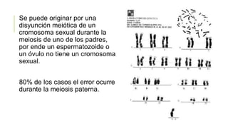 Se puede originar por una
disyunción meiótica de un
cromosoma sexual durante la
meiosis de uno de los padres,
por ende un espermatozoide o
un óvulo no tiene un cromosoma
sexual.
80% de los casos el error ocurre
durante la meiosis paterna.
 