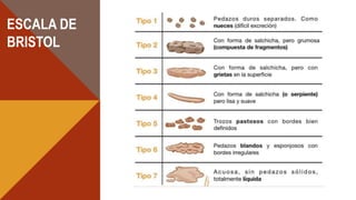 ESCALA DE
BRISTOL
 