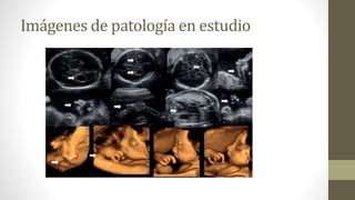 Imágenes de patología en estudio
 