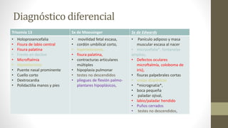 Diagnóstico diferencial
Trisomía 13 Sx de Moessinger Sx de Edwards
• Holoprosencefalia
• Fisura de labio central
• Fisura palatina
• Frente en declive
• Microftalmia
• Hipotelorismo
• Puente nasal prominente
• Cuello corto
• Dextrocardia
• Polidactilia manos y pies
• movilidad fetal escasa,
• cordón umbilical corto,
• hipertelorismo,
• fisura palatina,
• contracturas articulares
múltiples
• hipoplasia pulmonar
• testes no descendidos
• pliegues de flexión palmo-
plantares hipoplásicos,
• Panículo adiposo y masa
muscular escasa al nacer
• microcefalia*, fontanelas
amplias,
• Defectos oculares
microftalmía, coloboma de
iris),
• fisuras palpebrales cortas
• orejas displásicas
• *micrognatia*,
• boca pequeña
• paladar ojival,
• labio/paladar hendido
• Puños cerrados
• testes no descendidos,
 