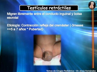  Alteraciones en el eje hipotálamo – pituitaria – testicular