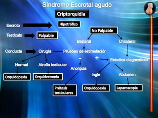  El testículo puede ser intraabdominal y no palparse. 