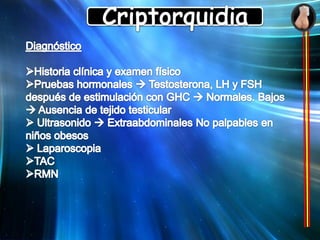  25% afectación bilateralTemas de Cirugía Pediátrica – Dr. Jesús Fernández