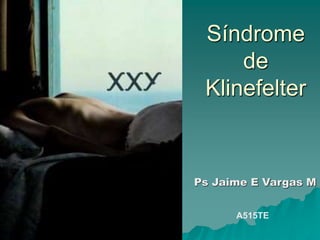 Síndrome
de
Klinefelter
Ps Jaime E Vargas M
A515TE
 