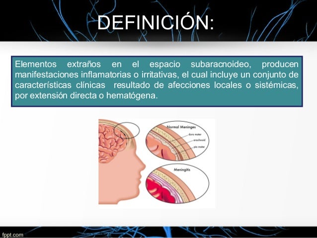 sindrome meningeo