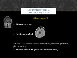 DX diferencial
o Absceso cerebral
o Empiema cerebral
Ambos: LCR presión elevada, leucocitosis, elevación proteínas,
glucosa normal.
o Absceso extradural (asociado a osteomielitis)
MENINGITIS PIÓGENA
(BACTERIANA) AGUDA
 