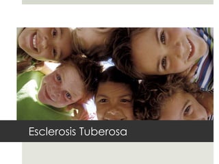 Esclerosis Tuberosa
 