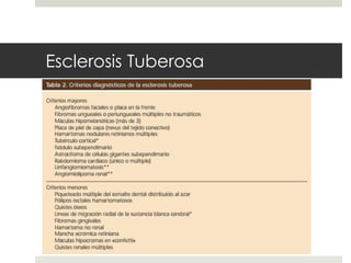 Esclerosis Tuberosa
 