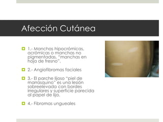 Afección Cutánea
 1.- Manchas hipocrómicas,
acrómicas o manchas no
pigmentadas, “manchas en
hoja de fresno”.
 2.- Angiofibromas faciales
 3.- El parche lijoso “piel de
marrasquino” es una lesión
sobreelevada con bordes
irregulares y superficie parecida
al papel de lija.
 4.- Fibromas ungueales
 