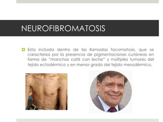 NEUROFIBROMATOSIS
 Esta incluida dentro de las llamadas facomatosis, que se
caracteriza por la presencia de pigmentaciones cutáneas en
forma de “manchas café con leche” y múltiples tumores del
tejido ectodérmico y en menor grado del tejido mesodérmico.
 