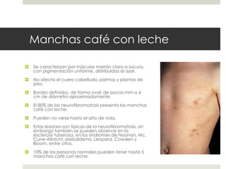 Manchas café con leche
 Se caracterizan por máculas marrón claro a oscuro,
con pigmentación uniforme, distribuidas al azar.
 No afecta el cuero cabelludo, palmas y plantas de
pies.
 Bordes definidos, de forma oval, de pocos mm a 4
cm de diámetro aproximadamente.
 El 80% de las neurofibromatosis presenta las manchas
café con leche.
 Pueden no verse hasta el año de vida.
 Estas lesiones son típicas de la neurofibromatosis, sin
embargo también se pueden observar en la
esclerosis tuberosa, en los síndromes de Noonan, Mc.
Cune-Albricht, piebaldismo, Leopard, Cowden y
Bloom, entre otros.
 10% de las personas normales pueden tener hasta 5
manchas café con leche.
 