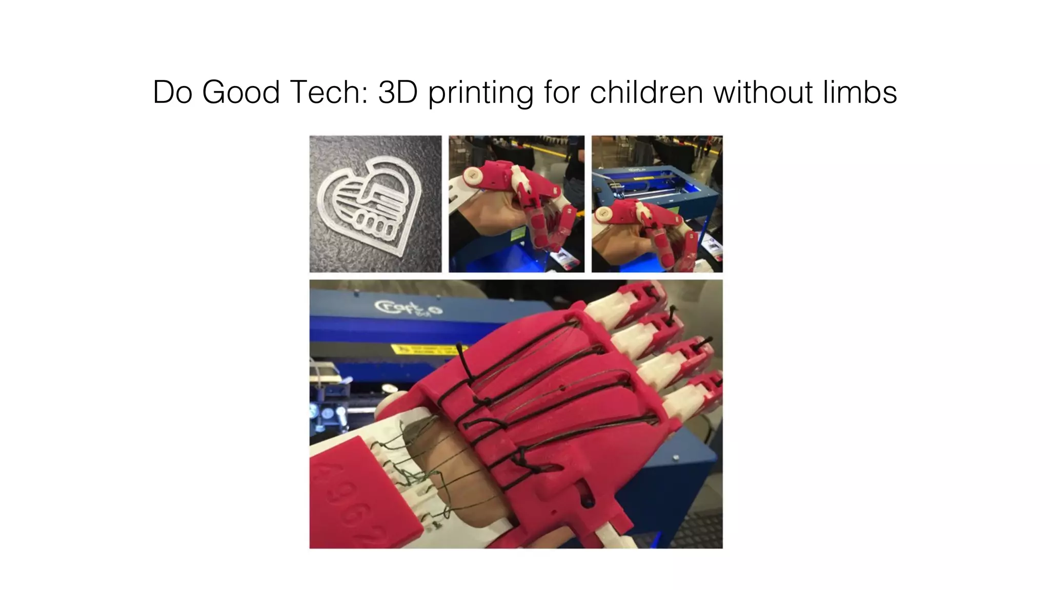 Do Good Tech: 3D printing for children without limbs!
 