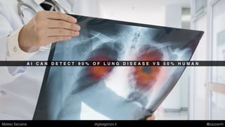 A I C A N D E T E C T 9 0 % O F L U N G D I S E A S E V S 5 0 % H U M A N
Matteo Sarzana digitalgonzo.it @zazzanm
 