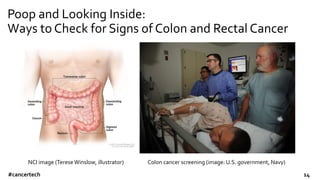 Poop and Looking Inside:
Ways to Check for Signs of Colon and Rectal Cancer
NCI image (TereseWinslow, illustrator) Colon c...