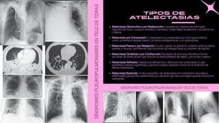 Comprehensive Overview of Pleuropulmonary Syndromes in Chest ...
