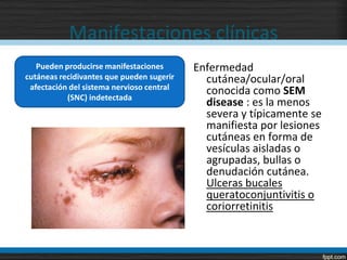 Manifestaciones clínicas
   Pueden producirse manifestaciones       Enfermedad
cutáneas recidivantes que pueden sugerir     cutánea/ocular/oral
 afectación del sistema nervioso central
           (SNC) indetectada
                                             conocida como SEM
                                             disease : es la menos
                                             severa y típicamente se
                                             manifiesta por lesiones
                                             cutáneas en forma de
                                             vesículas aisladas o
                                             agrupadas, bullas o
                                             denudación cutánea.
                                             Ulceras bucales
                                             queratoconjuntivitis o
                                             coriorretinitis
 