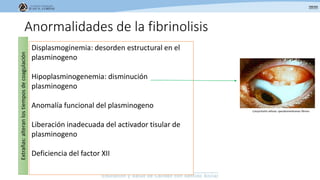 Anormalidades de la fibrinolisis
Displasmoginemia: desorden estructural en el
plasminogeno
Hipoplasminogenemia: disminución
plasminogeno
Anomalía funcional del plasminogeno
Liberación inadecuada del activador tisular de
plasminogeno
Deficiencia del factor XII
Extrañas:alteranlostiemposdecoagulación
Conjuntivitis leñosa: speudomenbranas fibrina
 