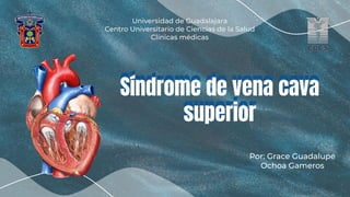 Por: Grace Guadalupe
Ochoa Gameros
Universidad de Guadalajara
Centro Universitario de Ciencias de la Salud
Clínicas médicas
Síndrome de vena cava
superior
Síndrome de vena cava
superior
 