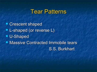 Tear PatternsTear Patterns
 Crescent shapedCrescent shaped
 L-shaped (or reverse L)L-shaped (or reverse L)
 U-ShapedU-Shaped
 Massive Contracted Immobile tearsMassive Contracted Immobile tears
S.S. BurkhartS.S. Burkhart
 