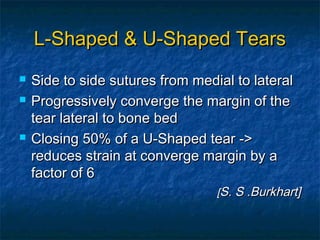 L-Shaped & U-Shaped TearsL-Shaped & U-Shaped Tears
 Side to side sutures from medial to lateralSide to side sutures from medial to lateral
 Progressively converge the margin of theProgressively converge the margin of the
tear lateral to bone bedtear lateral to bone bed
 Closing 50% of a U-Shaped tear ->Closing 50% of a U-Shaped tear ->
reduces strain at converge margin by areduces strain at converge margin by a
factor of 6factor of 6
[[S. S .Burkhart]S. S .Burkhart]
 