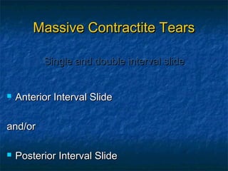 Massive Contractite TearsMassive Contractite Tears
 Anterior Interval SlideAnterior Interval Slide
and/orand/or
 Posterior Interval SlidePosterior Interval Slide
Single and double interval slideSingle and double interval slide
 