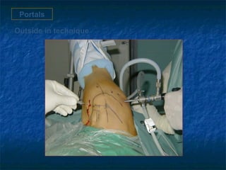 Portals
Outside in technique
 