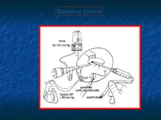Bleeding control
 