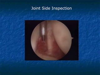 Joint Side Inspection
 