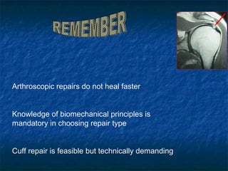 Arthroscopic repairs do not heal faster
Knowledge of biomechanical principles is
mandatory in choosing repair type
Cuff repair is feasible but technically demanding
 
