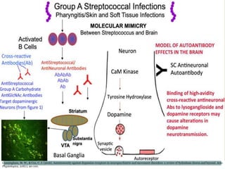 Pathophysiology
Cunningham, M. W., & Cox, C. J. (2016). Autoimmunity against dopamine receptors in neuropsychiatric and movement disorders: a review of Sydenham chorea and beyond. Acta
Physiologica, 216(1), 90-100.
 