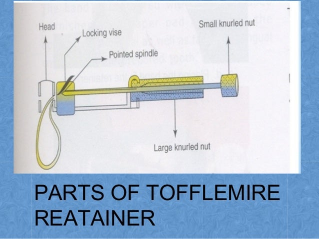 Types Of Matrix Retainer Parts Of Retainer Types Of Matrix Retainer Parts Of Retainer