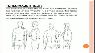 shoulder assessment (full)