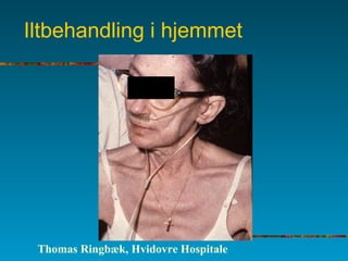 Iltbehandling i hjemmet
Thomas Ringbæk, Hvidovre Hospitale
 
