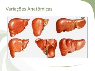 Variações Anatômicas
 