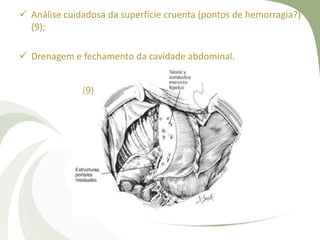  Análise cuidadosa da superfície cruenta (pontos de hemorragia?)
(9);
 Drenagem e fechamento da cavidade abdominal.
(9)
 